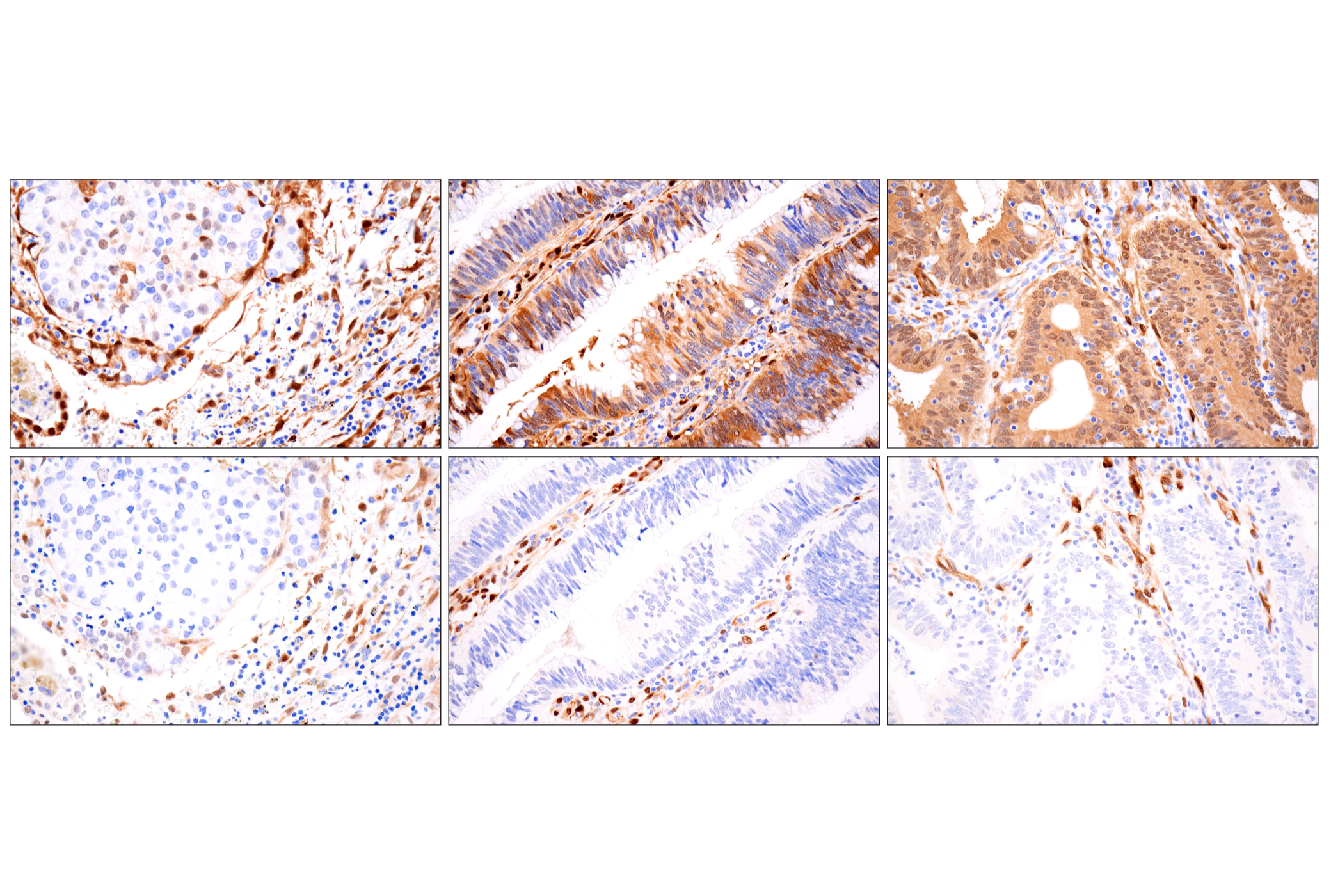 Hippo Pathway: Upstream Signaling Antibody Sampler Kit