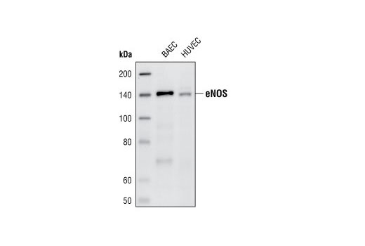 eNOS (49G3) Rabbit mAb