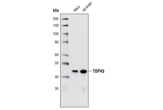 TDP43 (A260) Antibody