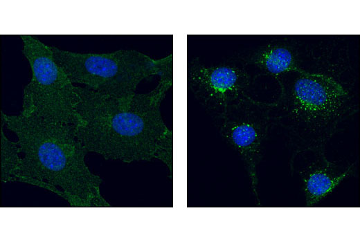 Cancer Associated Fibroblast Marker Antibody Sampler Kit