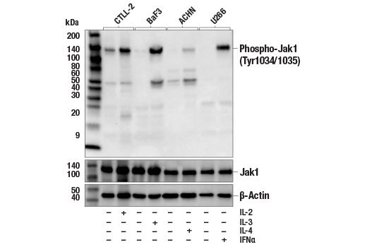 Phospho-Jak1 (Tyr1034/1035) Antibody