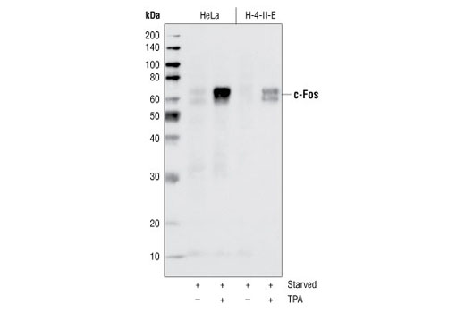c-Fos (9F6) Rabbit mAb
