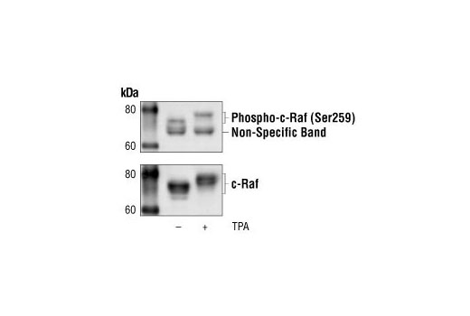 Phospho-Akt Pathway Antibody Sampler Kit