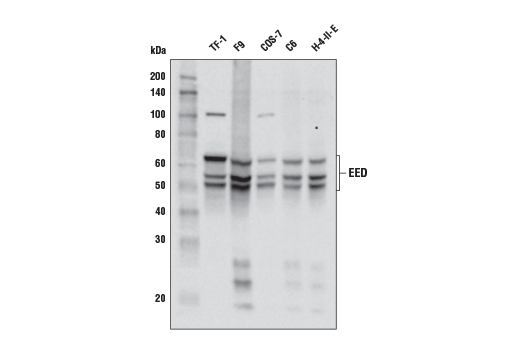 EED (E4L6E) XP ®  Rabbit mAb