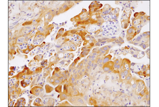 NF-kappaB Family Antibody Sampler Kit II