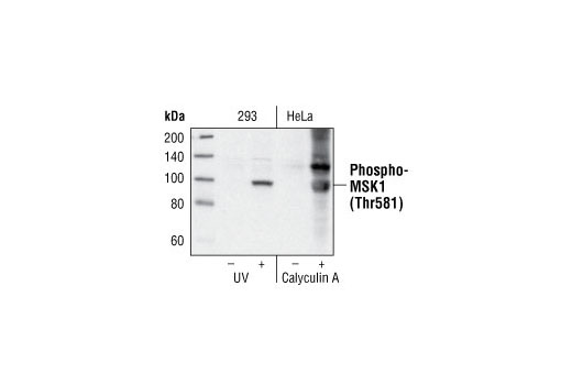 Phospho-Erk1/2 Pathway Antibody Sampler Kit