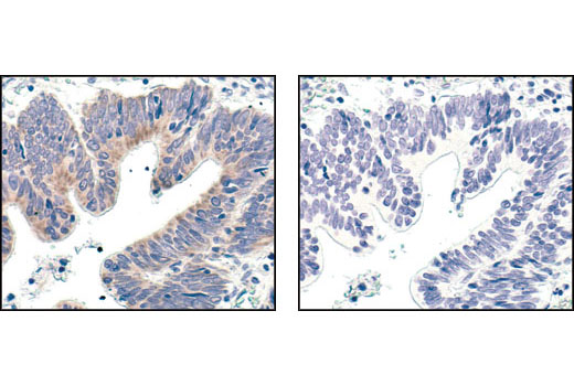 Pro-Survival Bcl-2 Family Antibody Sampler Kit II