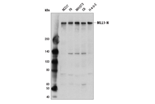 MLL1 (D2M7U) Rabbit mAb (Amino-terminal Antigen)