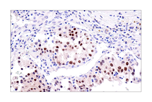 PAX8 (BC12) Mouse mAb