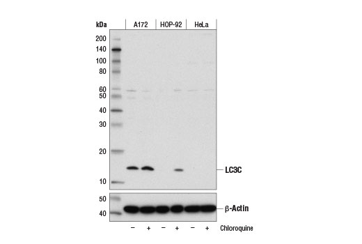 LC3C (D1R8V) Rabbit mAb