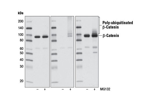 Non-phospho (Active) beta-Catenin (Ser33/37/Thr41) (D13A1) Rabbit mAb