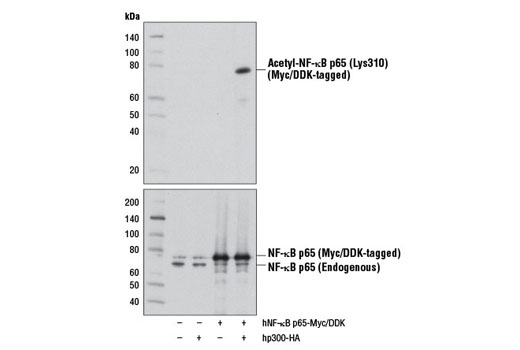 NF-kappaB p65 Antibody Sampler Kit