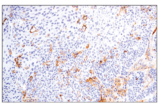 Exosomal Marker Antibody Sampler Kit