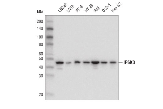 IP6K3 (D9O7J) Rabbit mAb