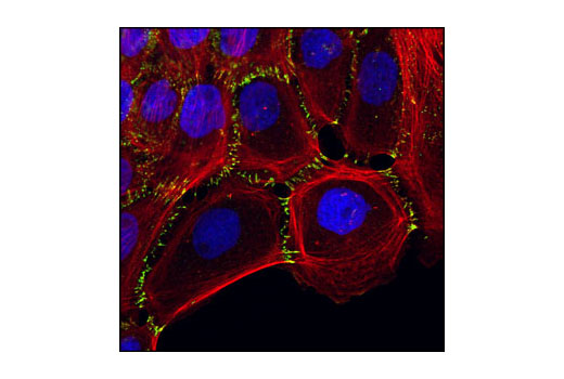 Cadherin-Catenin Antibody Sampler Kit