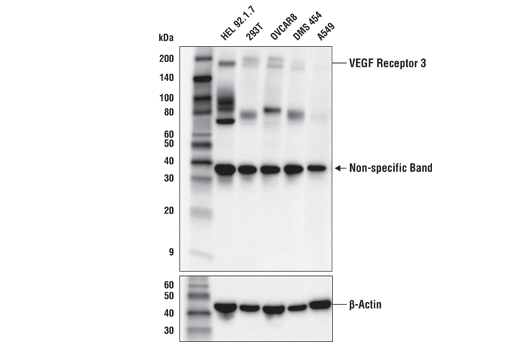 VEGF Receptor 3 (D1J9Z) Rabbit mAb