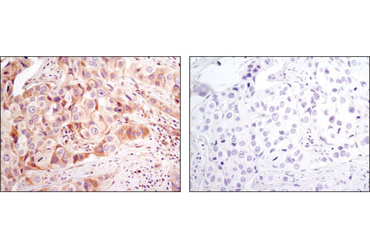 Pro-Apoptosis Bcl-2 Family Antibody Sampler Kit