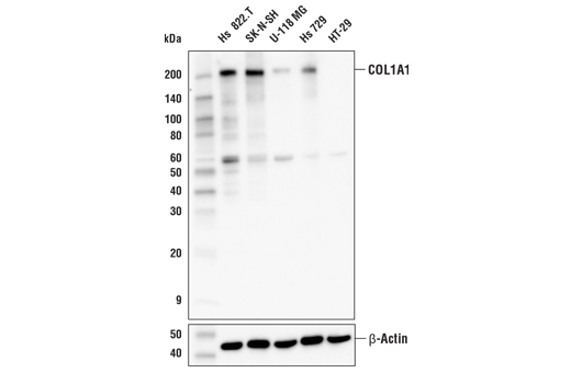 TGF-beta Fibrosis Pathway Antibody Sampler Kit