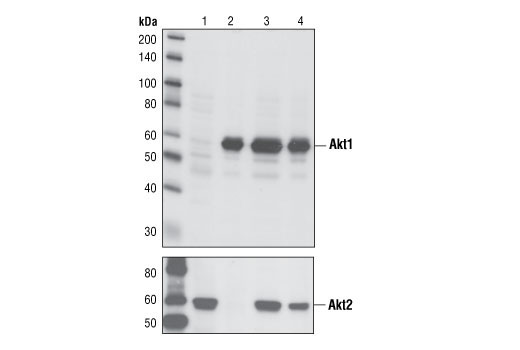 Phospho-Akt Isoform Antibody Sampler Kit