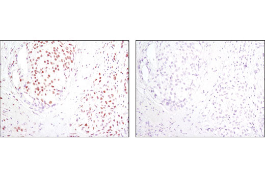 Hypoxia Pathway Antibody Sampler Kit