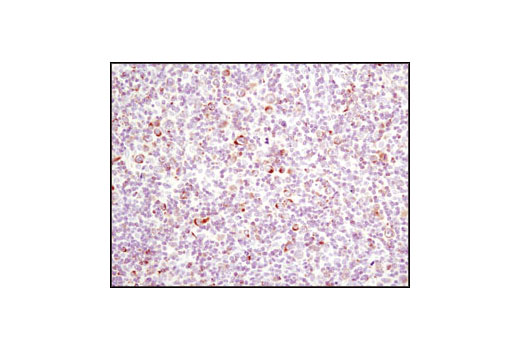 Pro-Apoptosis Bcl-2 Family Antibody Sampler Kit