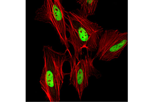 Class I HDAC Antibody Sampler Kit