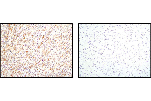 Cancer Associated Fibroblast Marker Antibody Sampler Kit