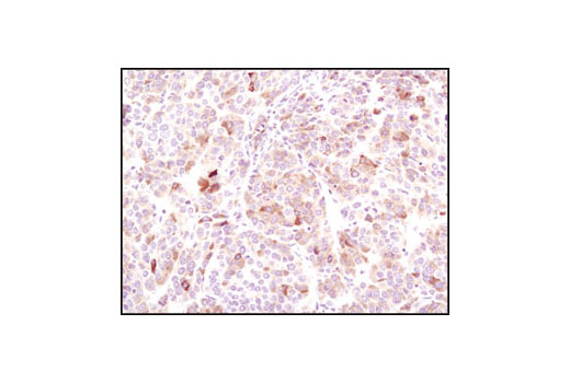 ER Stress-induced Autophagy Antibody Sampler Kit