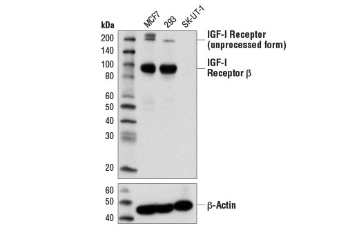 IGF-I Receptor beta (D4O6W) Rabbit mAb