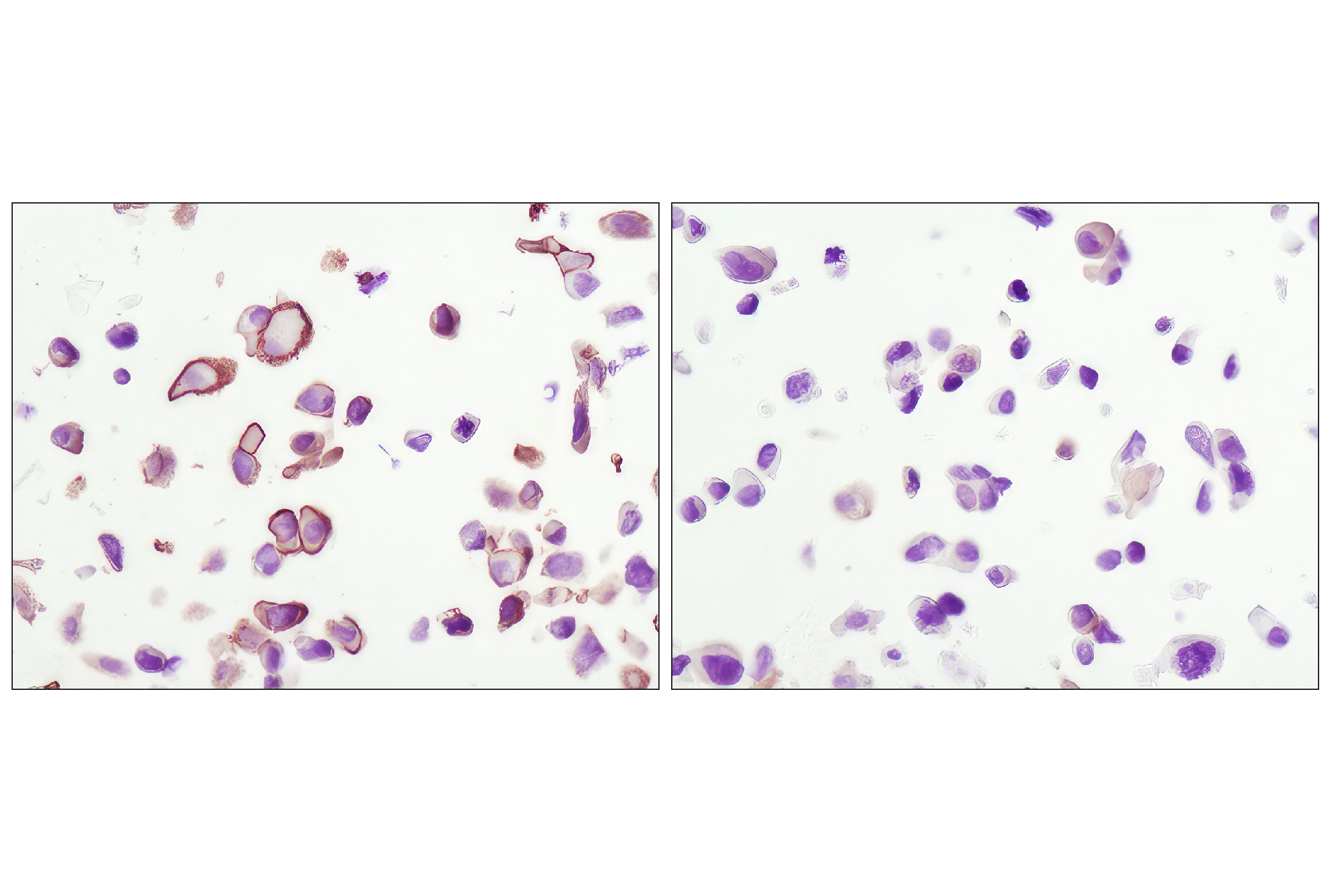 Angiogenesis Antibody Sampler Kit