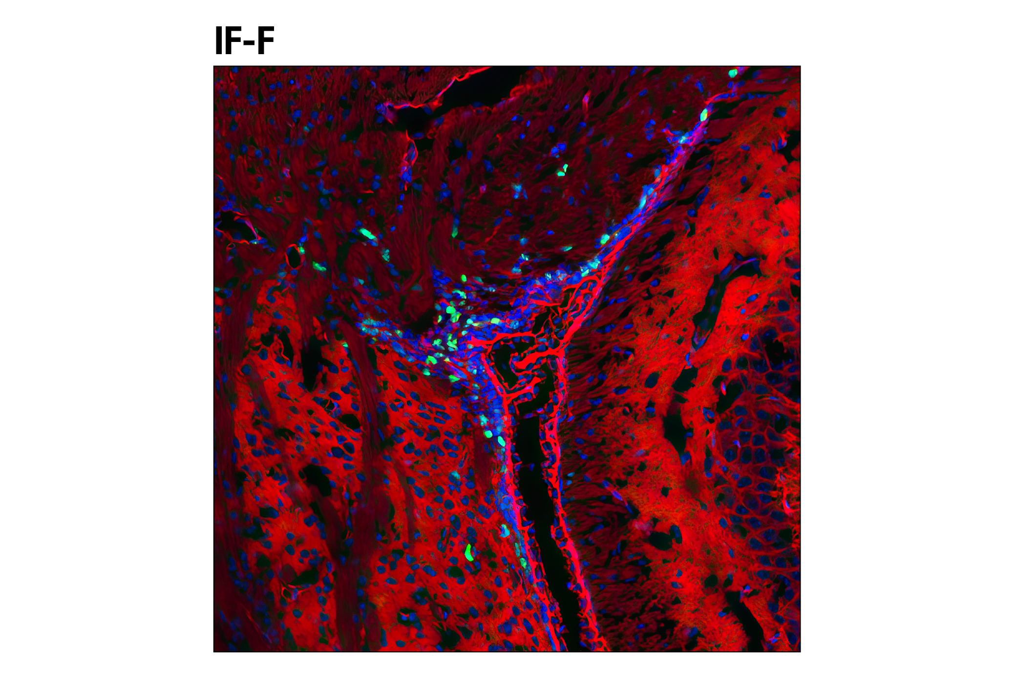 Ki-67 (D3B5) Rabbit mAb