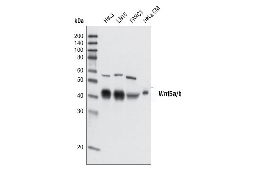 Wnt Signaling Antibody Sampler Kit