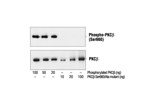 Phospho-PKC (pan) (betaII Ser660) Antibody