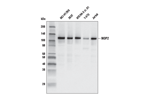 NOP2 (G754) Antibody