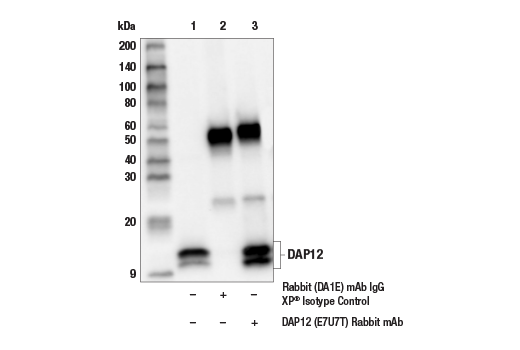 Human TREM2 Activity Antibody Sampler Kit