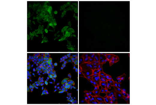 Human TREM2 Activity Antibody Sampler Kit