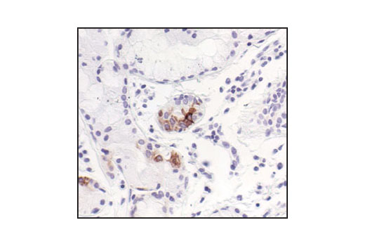 NF-kappaB Pathway Antibody Sampler Kit