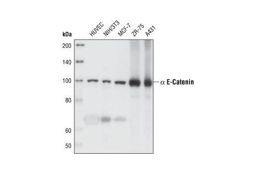 Cadherin-Catenin Antibody Sampler Kit