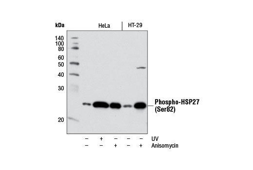 Phospho-p38 MAPK Pathway Antibody Sampler Kit