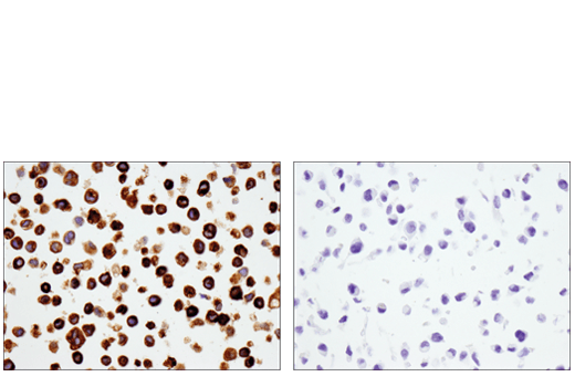 TGF-beta Fibrosis Pathway Antibody Sampler Kit