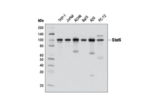 Stat6 (D3H4) Rabbit mAb