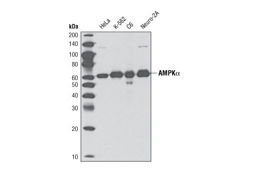 ULK1 Antibody Sampler Kit