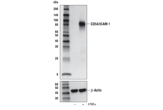 CD54/ICAM-1 (E3Q9N) XP ®  Rabbit mAb