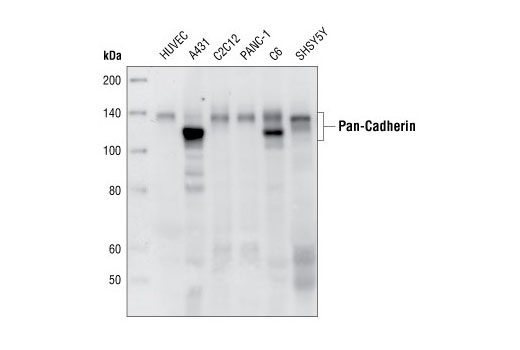 Cadherin-Catenin Antibody Sampler Kit