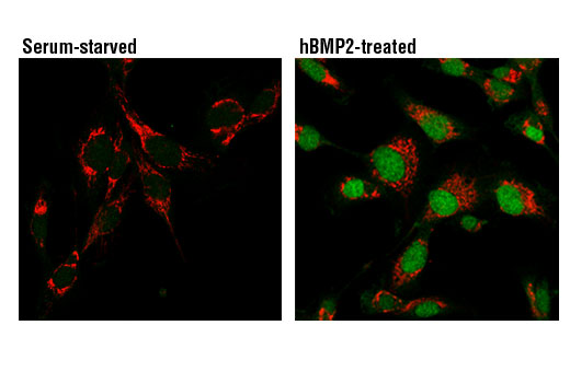 SMAD 1/5/9 Antibody Sampler Kit