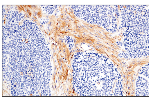 Exosomal Marker Antibody Sampler Kit