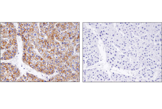 Exosomal Marker Antibody Sampler Kit