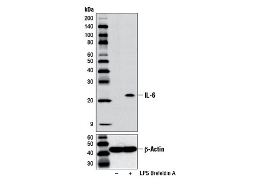 IL-6 (D5W4V) XP ®  Rabbit mAb