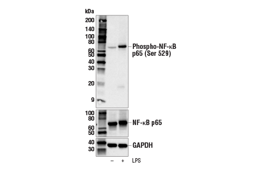 NF-kappaB Pathway Antibody Sampler Kit II