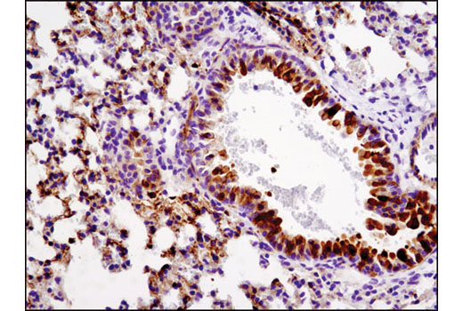 Phospho-p38 MAPK Pathway Antibody Sampler Kit